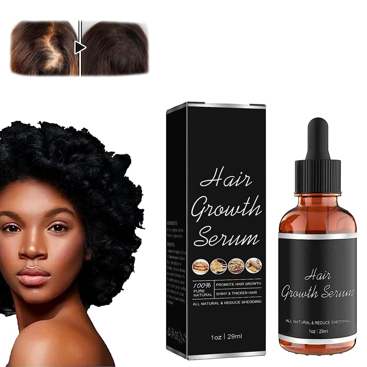 Noor Hair Growth Serum African Olives, Noor Love Hair Growth Serum | eBay Noor Hair Growth Serum African Olives, Noor Love Hair Growth Serum | eBay