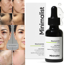 Minimalist 10 Niacinamide Serum Reduces Acne Marks, Controls Oil 30 ml