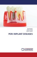 Peri Implant Diseases Vinita A. Boloor