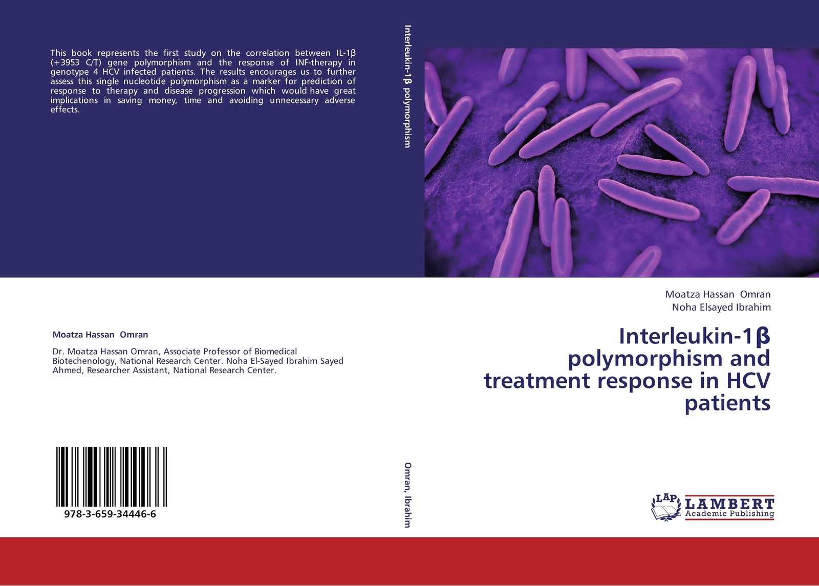 Thumbnail - Moatza Hassan Omran (u. A.) | Interleukin-1¿ Polymorphism And