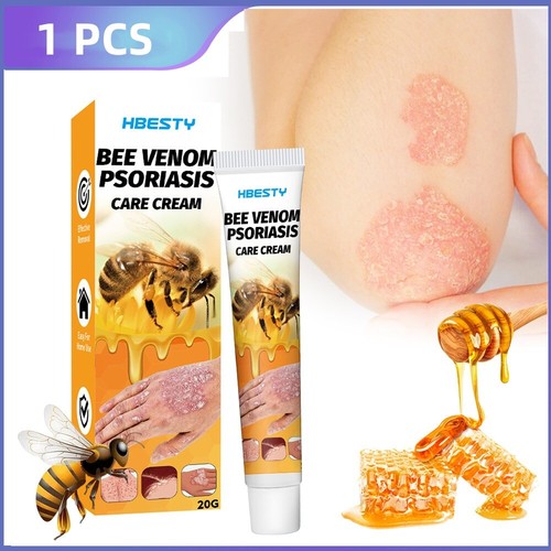 Crema para psoriasis veneno de abeja 20G tratamiento de la piel cuero cabelludo mano pie fórmula suave - Imagen 10 de 11
