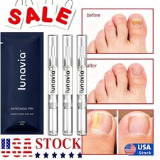 15 Pack Lunavia Antifungal Pen, 25 Undecylenic Acid Toenail Fungus Treatment