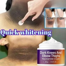 Strong Whitening Dark Skin Knuckles Feets Knees Elbows Armpit inner Thigh Cream