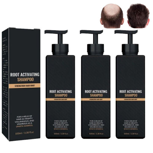 5x Spartan Shampoo,Spartan Root Activator Shampoo,Natural Hair Regrōwth Shampoos - Picture 14 of 15