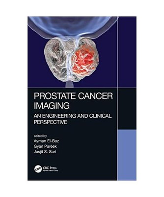 Prostate Cancer Imaging: An Engineering and Clinical Perspective