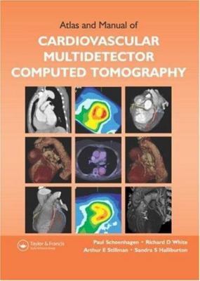 Atlas and Manual of Cardiovascular Multidetector Computed Tomography