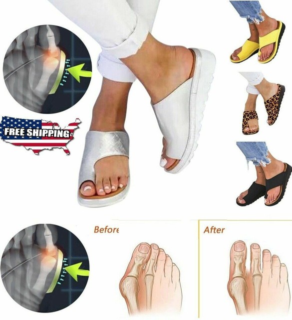 best walk orthopedic premium toe corrector sandals