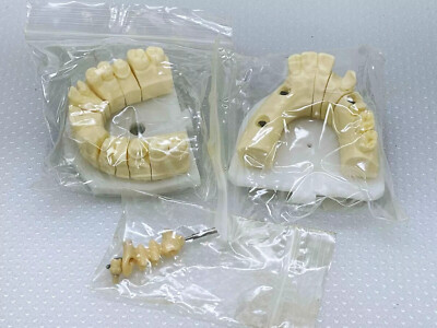 Dental Prosthetic Sample Model, Abutment, Crown & Bridge, New Open Box