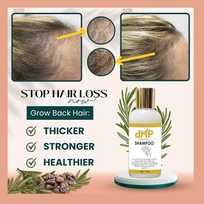  Shampoo Castor Oil Rosemary Argan Oil Thickening 4oz 118ml