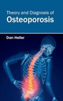 Dan Heller | Theory And Diagnosis Of Osteoporosis | Buch | Englisch (2015)