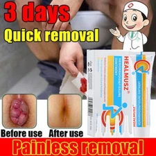 Hemorrhoids Remove Ointment Herbal Cream Relief Piles Pain Reduce Itching SALE