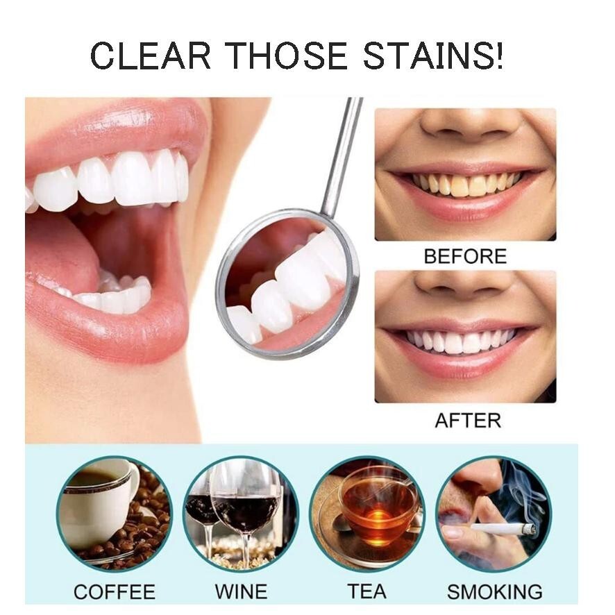 STRONG TEETH WHITENING GEL NO36 ADVANCED BLEACH PROFESSIONAL GRADE eBay