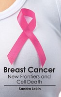 Sandra Lekin | Breast Cancer | Buch | Englisch (2015) | Gebunden