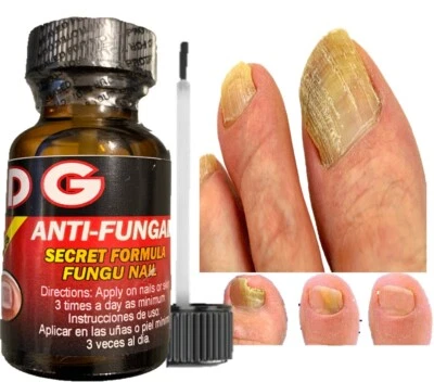 DG HOGO SANA HONGO SAN DG Premium Anti-Fungal Anti-Infectious Liquid / Hongos de Uñas y Pies