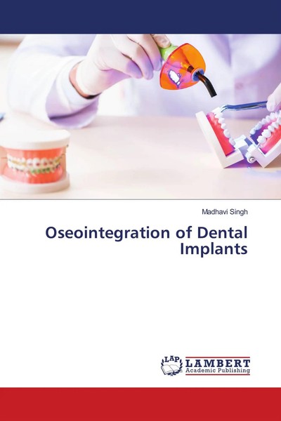 Madhavi Singh | Oseointegration Of Dental Implants | Taschenbuch | Englisch-image
