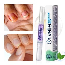 1/2/3 Pcs Orivelle Anti Pen, Swissclear Anti Fungal Pen Anti Fungal Nai