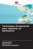Amisha Bhut (U. A.) | Techniques D'empreinte Pour Implants En Dentisterie | Buch