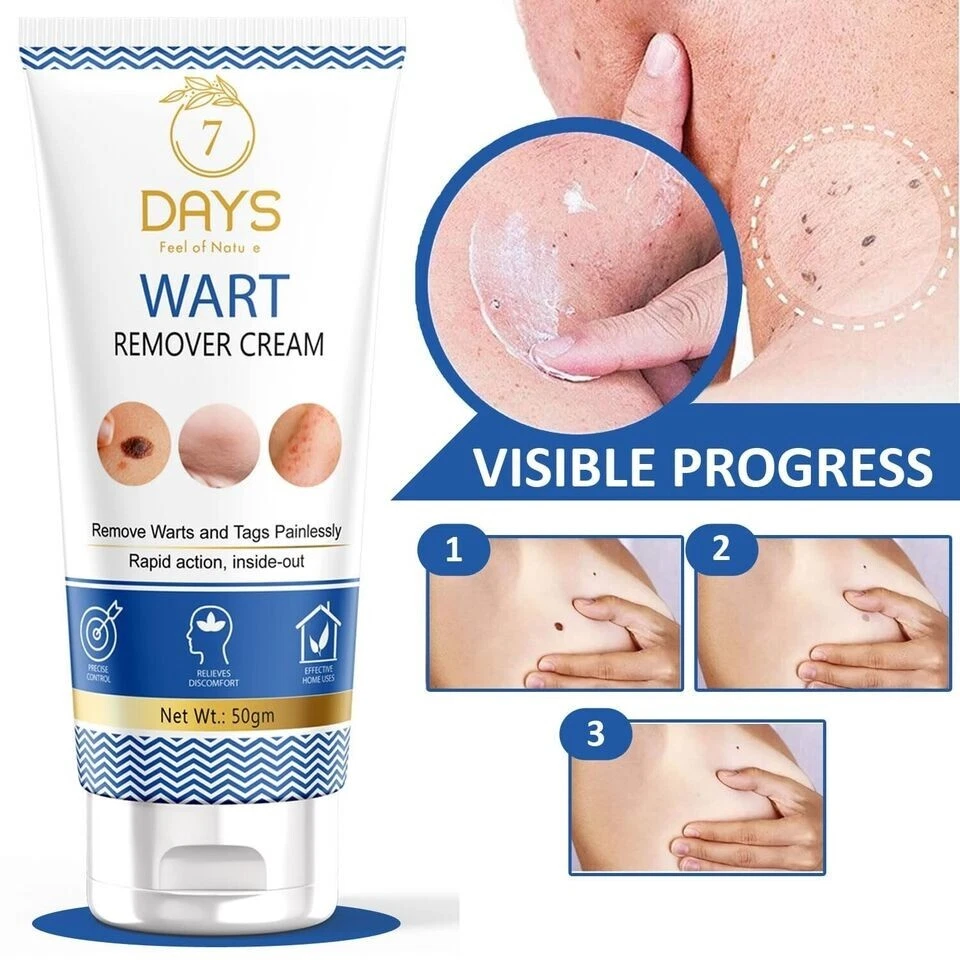 7 Days Wart Remover Cream for Men & Women for face neck cheeks forehead 50gm - Image 2 of 4