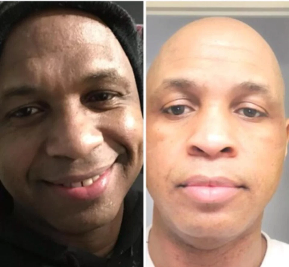 White Fade Dark Spots Remover Creams for All Types Of Skin 2 oz Per Unit. - Image 4 of 4