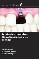 Implantes Dentales: Complicaciones Y Su Manejo Neha Verma (U. A.) Taschenbuch