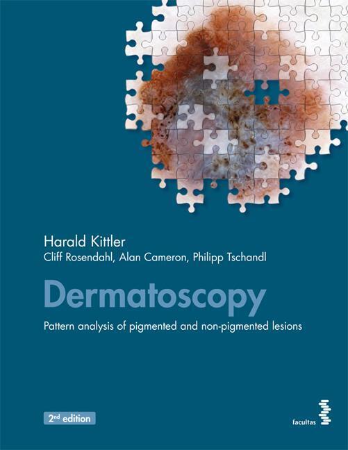 Thumbnail - Dermatoscopy | Harald Kittler (u. A.) | Taschenbuch | 392 S. |