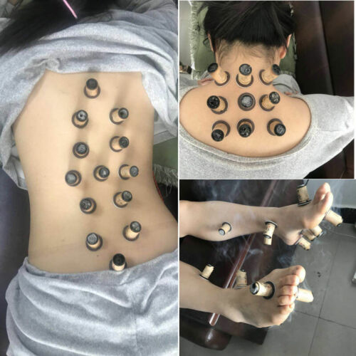 30 pièces autocollant de massage chinois rouleau moxa moxibustion thérapie pâte d'armoise  - Photo 1 sur 6