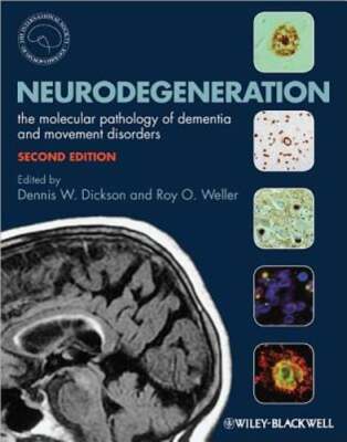 Neurodegeneration: The Molecular Pathology of Dementia and Movement Disorders
