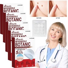 45 PCS Microneedle Botanic Skin Tag Acne Patch Skin Tag Remover Patches HOT