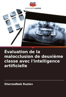 Sherzodbek Ruziev | ÉValuation De La Malocclusion De DeuxièMe Classe Avec...