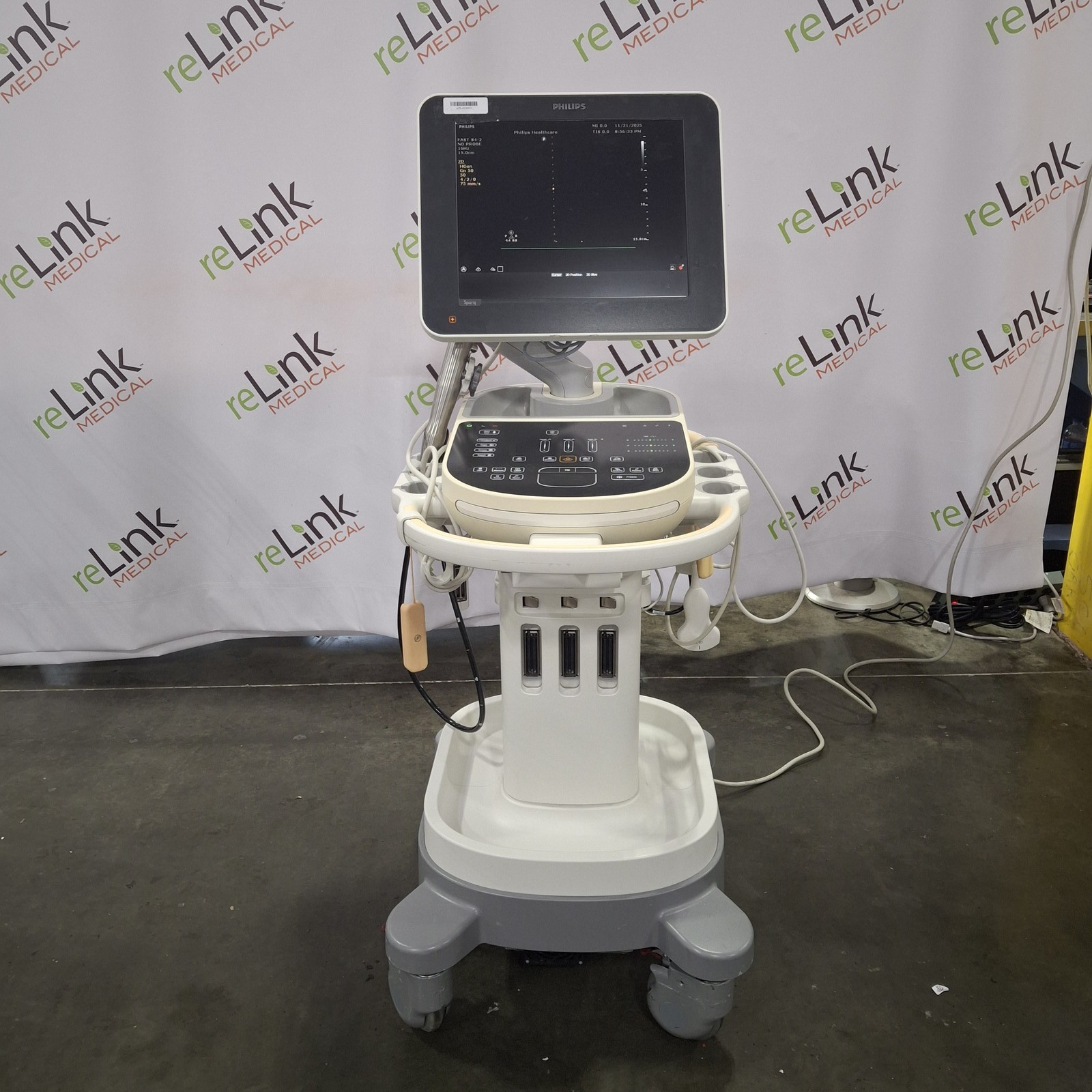 Philips Sparq Ultrasound System