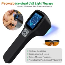 Medical Uvb Light for Skin Phototherapy UV Light Therapy for Face White Spots
