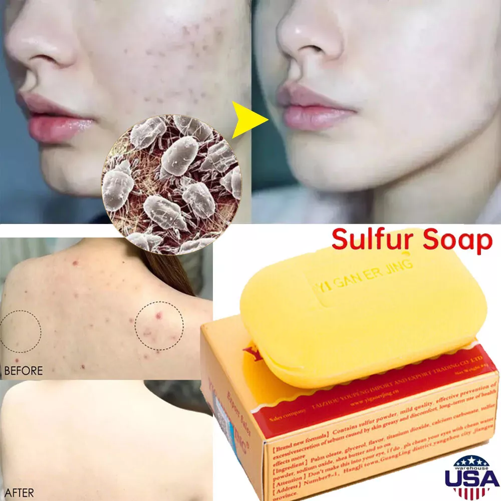 Face washes 2024 with sulfur