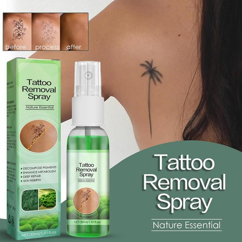 Quick Tattoo Removal Cream Natural Safe Pigment Cleaning Remover Tattoo Spray F5 - Picture 3 of 16