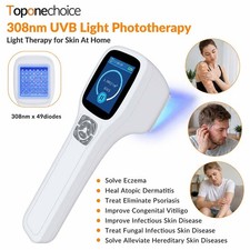 308nm Excimer UVB Phototherapy Device Skin Repair Light Therapy Instrument Home