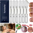 Lunavia Antifungal Pen, 25% Undecylenic Acid – Toenail Fungus Treatment 15 Pack