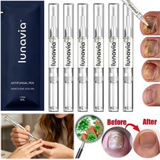 Lunavia Antifungal Pen, 25 Undecylenic Acid Toenail Fungus Treatment 15 Pack