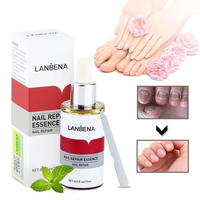 Nail Repair Essence, Fingernail & Toenail Repair Nail Treatment 0.5fl.oz