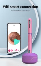 Strumento rimozione cera otoscopio fotocamera pulitore orecchie HD USB C endoscopio Earpick NK3 Pro