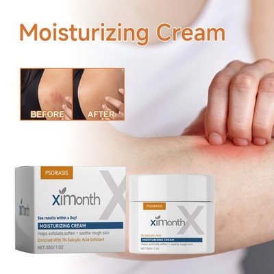 Skin Relief Body Cream Soothing Moisturizer for Dry and Itchy Skin Care