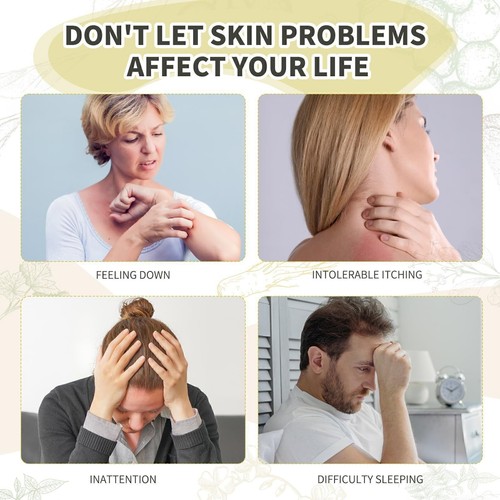 1/3/6pcs Eczema Cream Natural Organic Herbal Skin Cream Healing Cream - Afbeelding 10 van 11