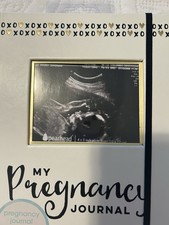 Pearhead  My Pregnancy Journal Pregnancy Book  Capture Every Precious Moment