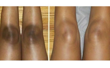 Skin Brightening Cream Extra Strength Lighter FAST Result-NO SIDE EFFECTS 15gm