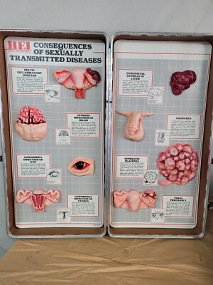 Health EdCo Consequences Of Sexually Transmitted Diseases Display Vintage