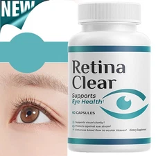 Retinal transparent capsule, retinal transparent capsule, protect eye health