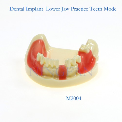 Modelo de implante y restauración de tipodonte dental modelo de demostración práctica de dientes modelo de tipodonte - Imagen 45 de 61