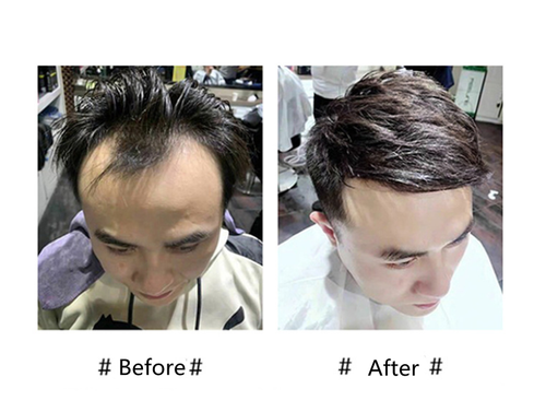 Pieza de cabello 100 % humano frontal para hombre tupé línea de cabello natural - Imagen 8 de 9