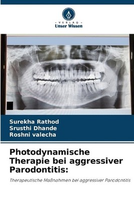 Photodynamische Therapie bei aggressiver Parodontitis by Surekha Rathod (German)