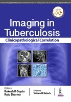 Rakesh K Gupta (U. A.) | Imaging In Tuberculosis | Taschenbuch | Englisch (2019)