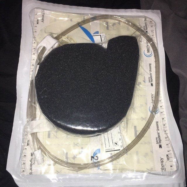 KCI V A C Simplace Ex Dressing Medium For Wound VAC Therapy New EBay kci-v-a-c-simplace-ex-dressing-medium-for-wound-vac-therapy-new-ebay
