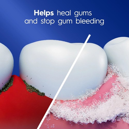Crest Pro-Health Gum Detoxify Toothpaste, 4.8 oz (136 g), 3 Pack - Picture 6 of 11